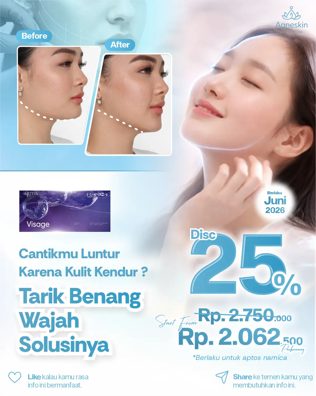 Promo Tarik Benang Wajah Juni 2026